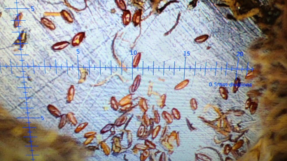 Seeds in a microscope 